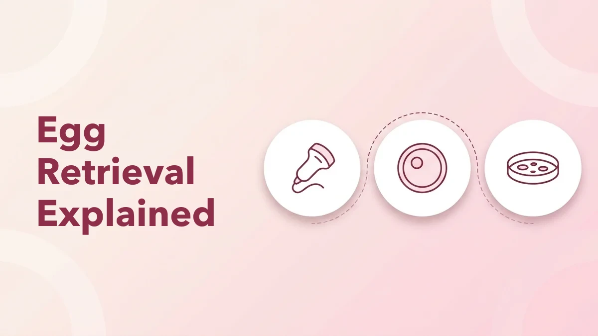Egg Retrieval (Ovum Pick-Up) in Chennai