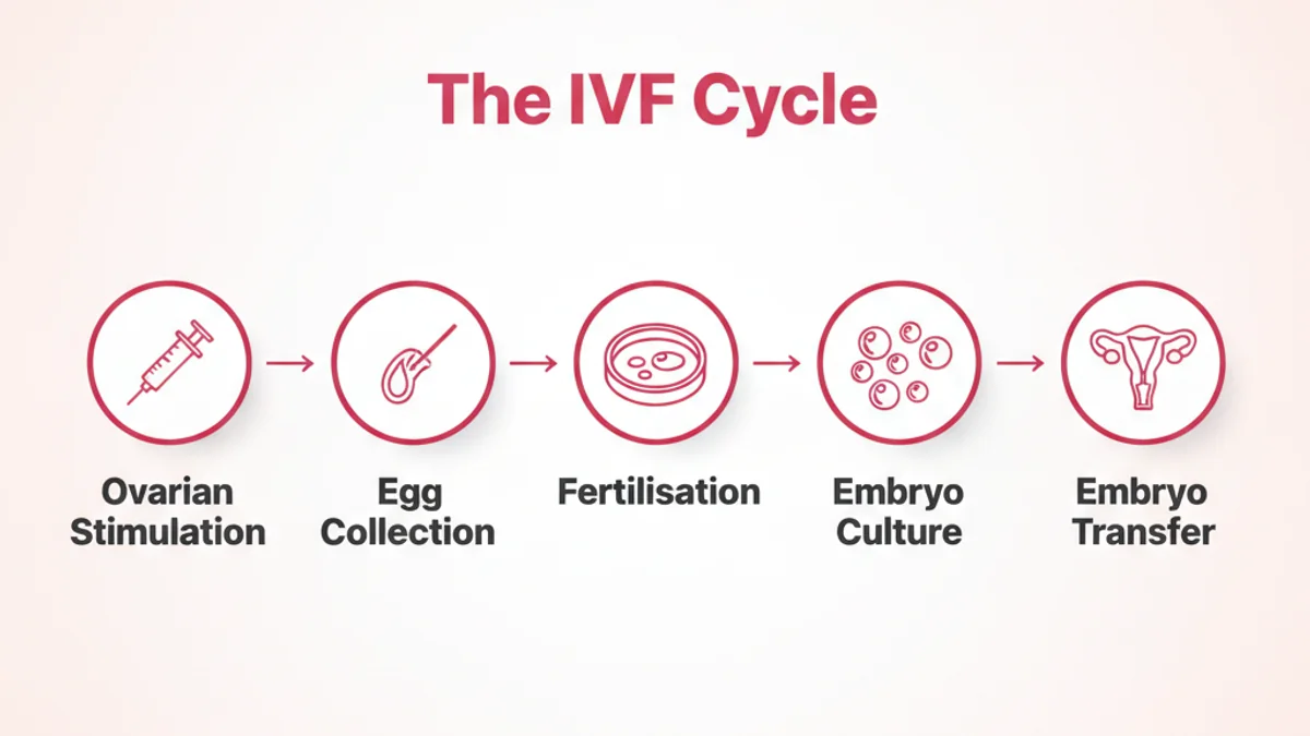 The five stages of one IVF cycle — ovarian stimulation, egg collection, fertilisation, embryo culture, and embryo transfer