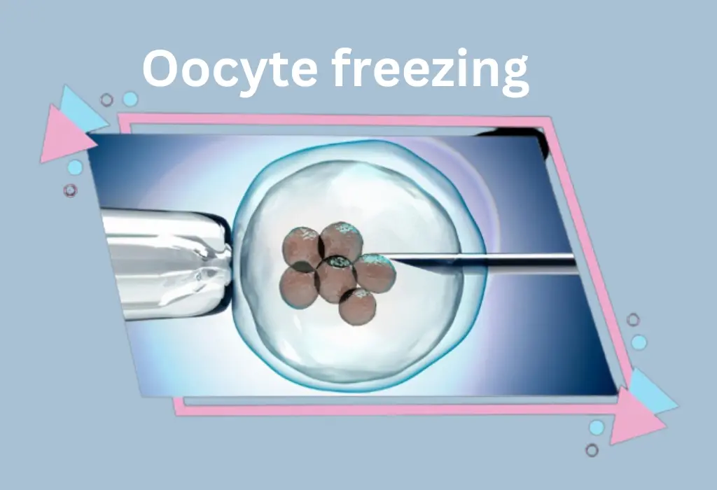 Oocyte freezing