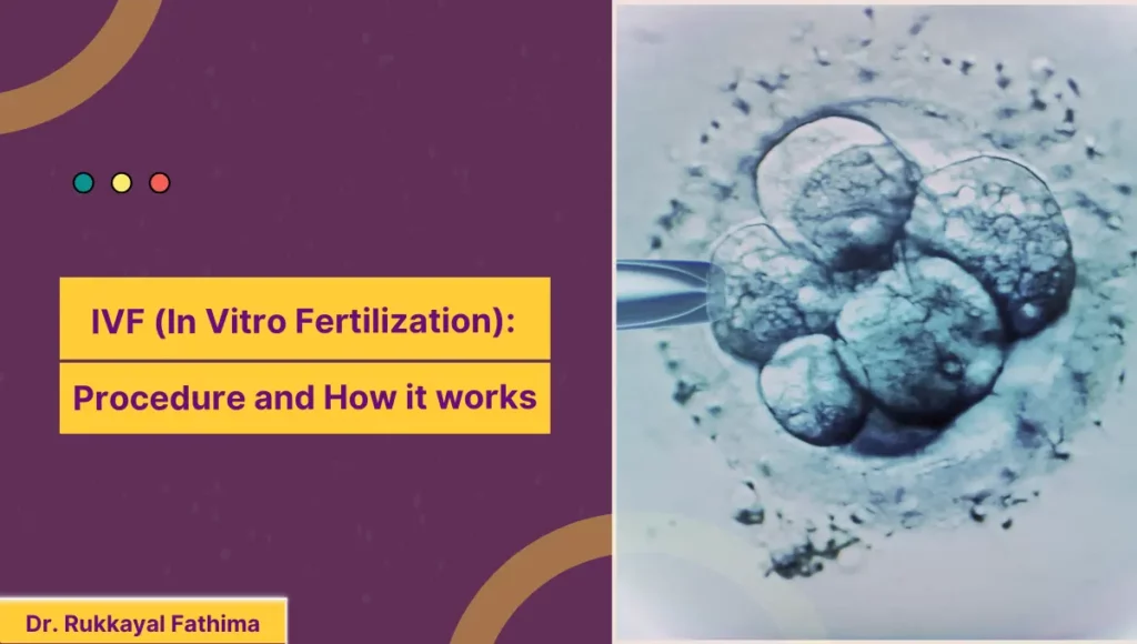 Image of IVF (In Vitro Fertilization) Procedure and How it works
