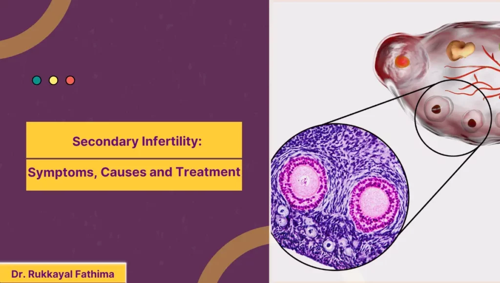 Image of Secondary Infertility Symptoms, Causes and Treatment