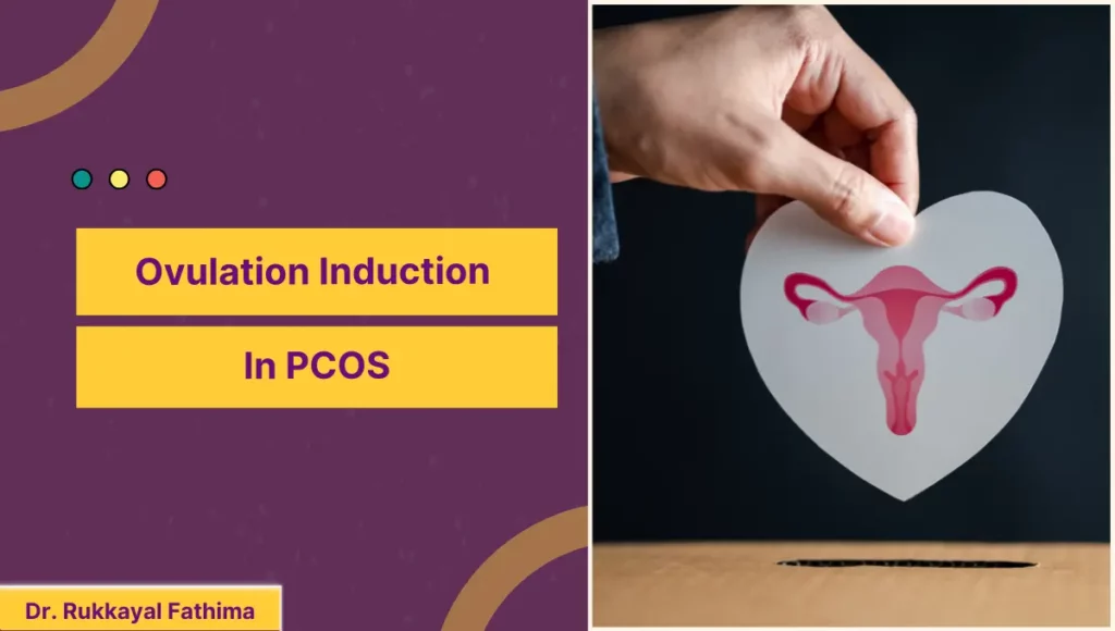 Ovulation Induction In PCOS