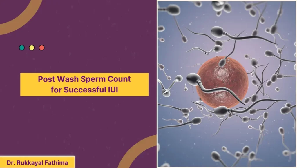 Post Wash Sperm Count for Successful IUI