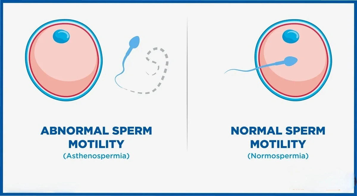 difference-between-normal-and-abnormal-sperm-motility-